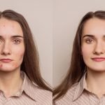Plastic surgeon in chennai | cosmetic surgery in chennai