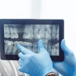 Dental Implants Near Me